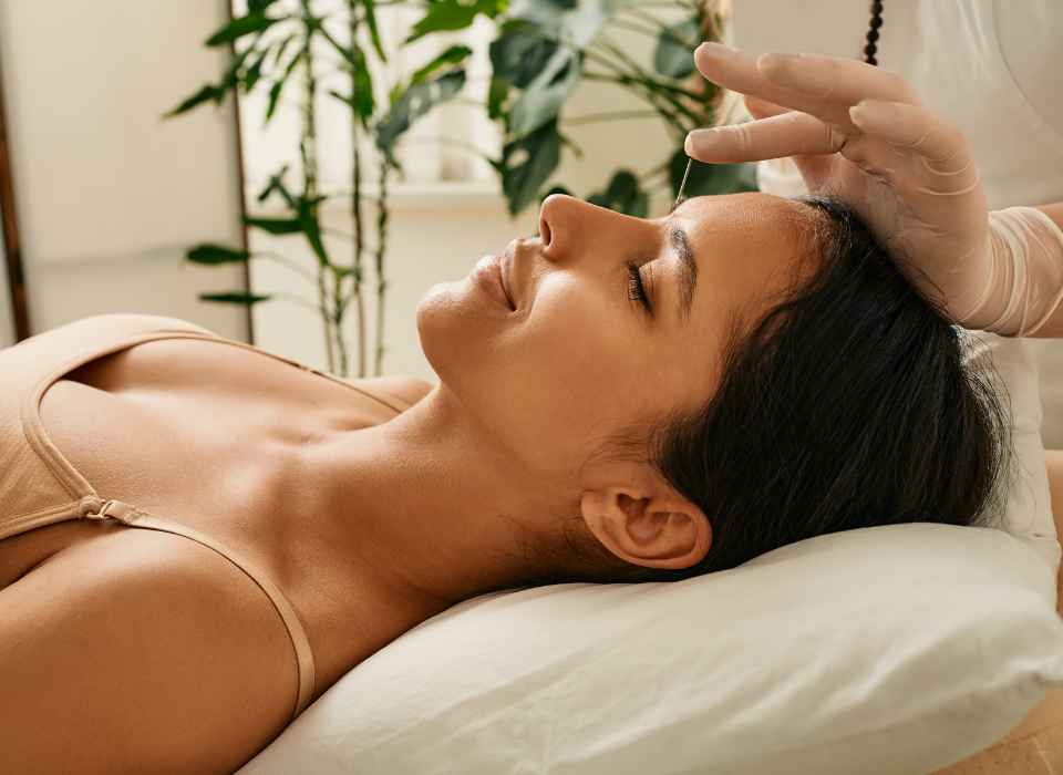 acupuncture-2