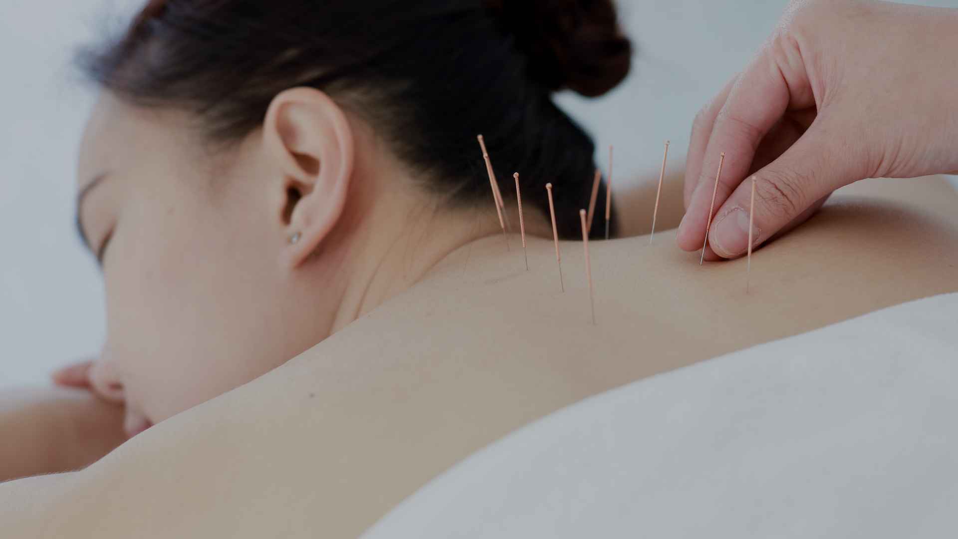 acupuncture-banner-1